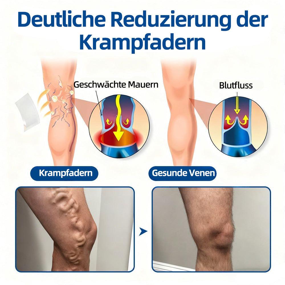 ✅𝐅𝐥𝐨𝐫𝐢𝐬𝐦𝐚®𝐕𝐞𝐧𝐞𝐧-𝐙𝐢𝐞𝐥 𝐌𝐢𝐤𝐫𝐨𝐧𝐚𝐝𝐞𝐥𝐩𝐟𝐥𝐚𝐬𝐭𝐞𝐫⚡Sofortige Linderung, langfristige Ergebnisse (upsell)